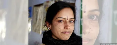 leprosy is making a comeback in india  but the govt wants to deny it