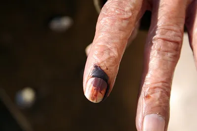 dwindling voter turnout shows discontent and political apathy in 2nd phase of lok sabha polls