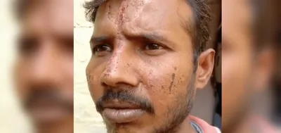 up man says miscreants called him  chamar   carved a trident with acid on his forehead