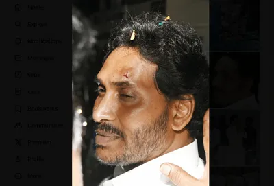election commission seeks report on alleged attack on jaganmohan reddy