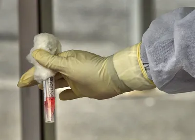 icmr removes covid 19 test price cap but private labs call government s bluff