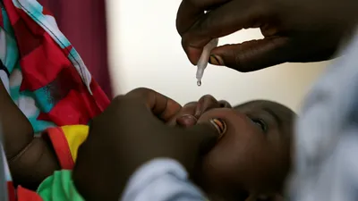 rapid spread of polio in the congo threatens global eradication efforts