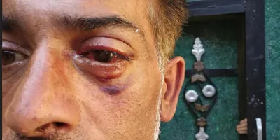 does the state have the right to maim with pellet guns 