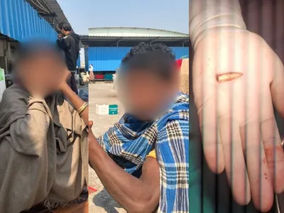 abujhmad  encounter   bullet taken out of minor s throat  two kids in  police custody   says activist