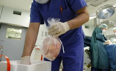 why moral exhortations alone will not boost organ donation in india