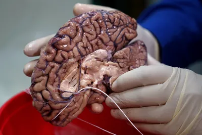 scientists hunt down genes behind humankind s big brain