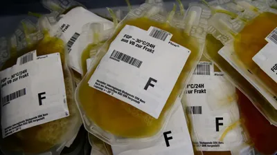 watch   covid 19 updates  plasma therapy not a proven cure  only to be used for research  mohfw