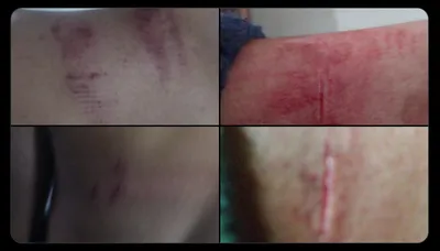 kashmiri students attacked by mob in punjab s kharar  police begins investigation