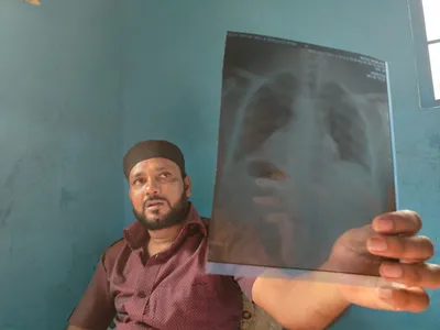 delhi riots  8 months later  victim still has bullet in leg and hasn t received compensation