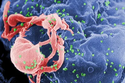the anti hiv treatments that could be actually revolutionary
