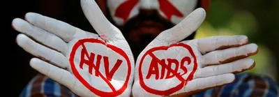 un  global fight against aids at a  precarious point 